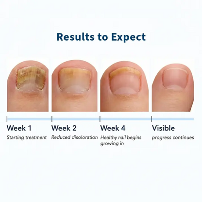 Fungal Nail Patches