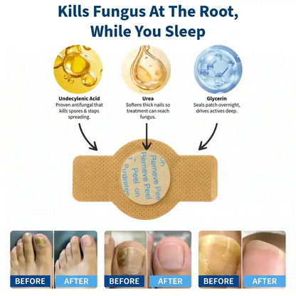 Fungal Nail Patches