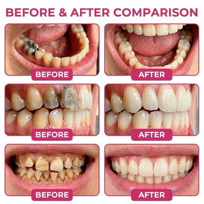 COUGEX® Cavity-Repair Natural Enamel Filling Gel
